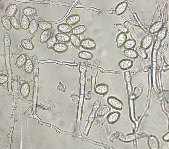 分生子柄と分生子の画像