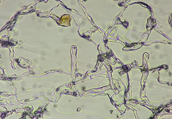 分生子柄と分生子の画像