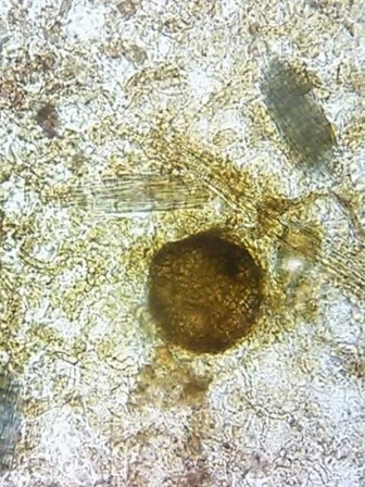 病原菌の分生子殻の画像