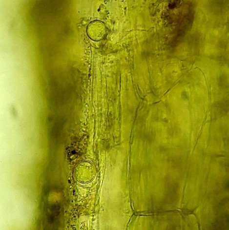 病原菌の欄胞子の画像